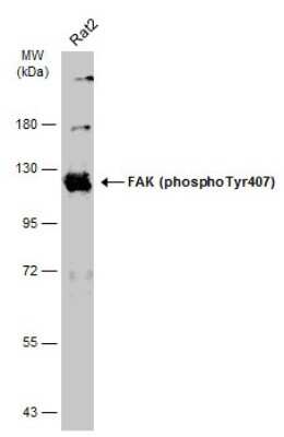 Western Blot: FAK [p Tyr407] Antibody [NBP3-13085]